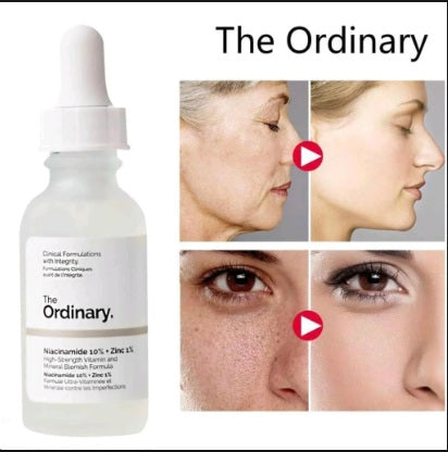 Niacinamide The Ordinary