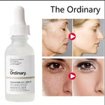 Niacinamide The Ordinary